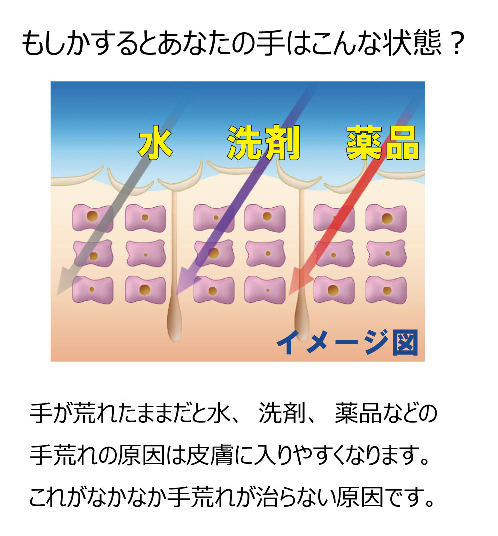 もしかするとあなたの手はこんな状態？