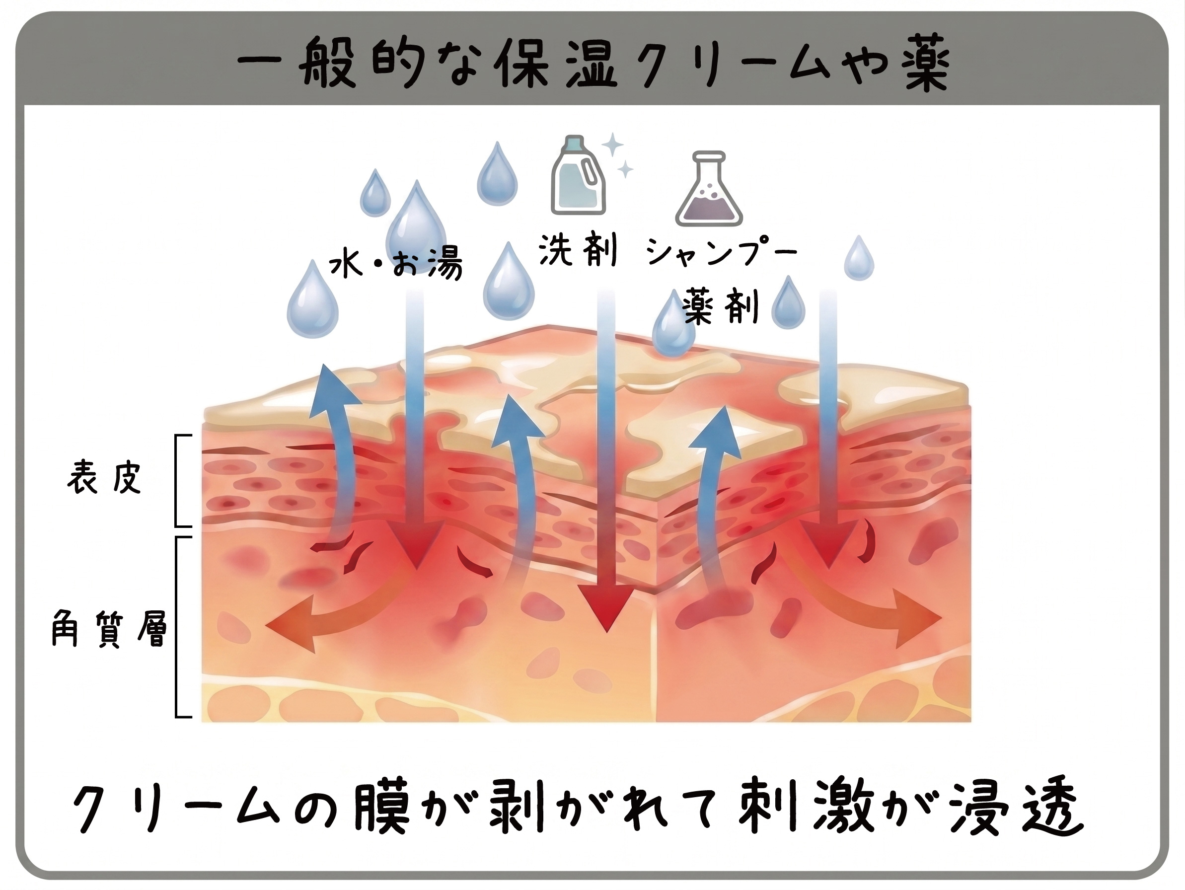 一般的な保湿クリームのメカニズム